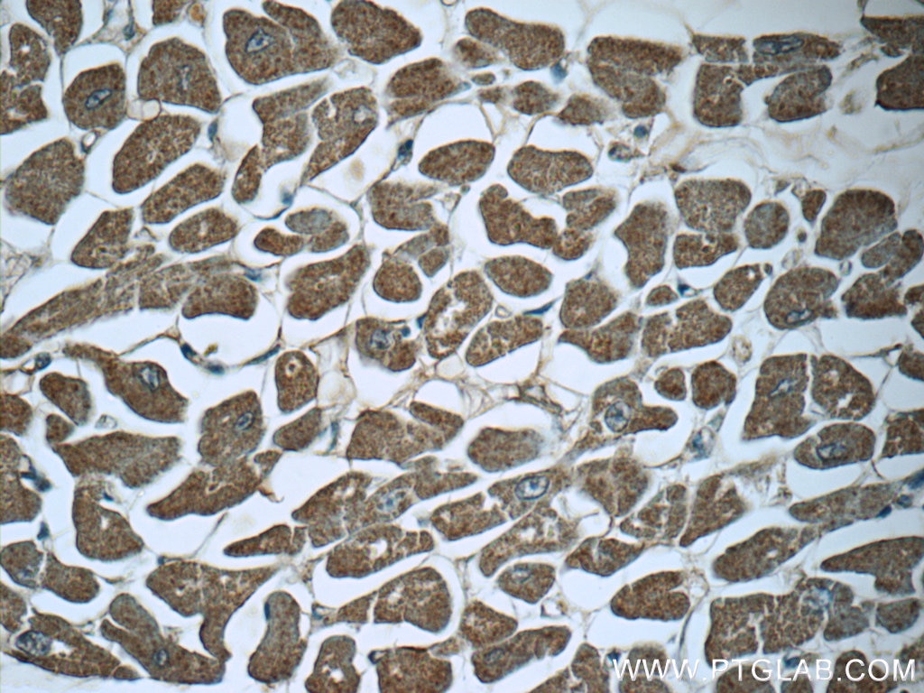 Immunohistochemistry (IHC) staining of human heart tissue using SRR Polyclonal antibody (17955-1-AP)