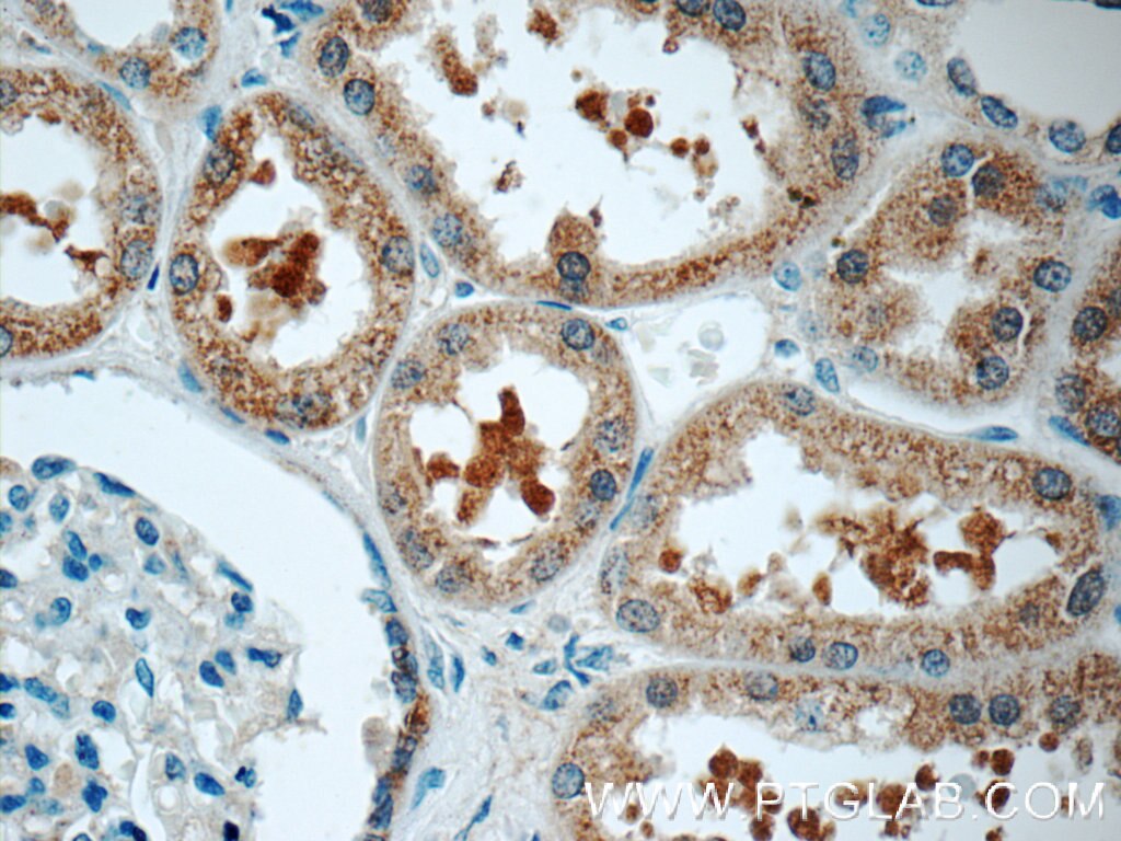 IHC staining of human kidney using 17955-1-AP