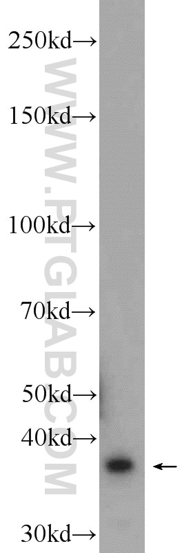 Western Blot (WB) analysis of rat brain tissue using SRR Polyclonal antibody (17955-1-AP)