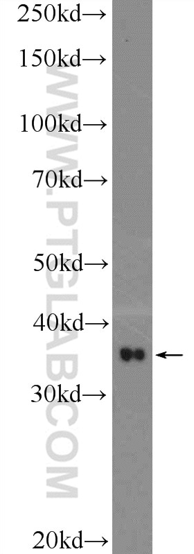 Western Blot (WB) analysis of mouse brain tissue using SRR Polyclonal antibody (17955-1-AP)