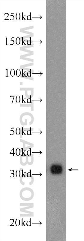 WB analysis of mouse brain using 17955-1-AP