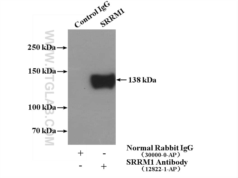 Immunoprecipitation (IP) experiment of HeLa cells using SRRM1 Polyclonal antibody (12822-1-AP)