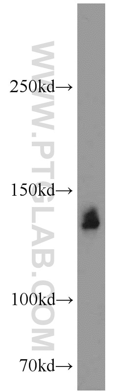 Western Blot (WB) analysis of mouse liver tissue using SRRM1 Polyclonal antibody (12822-1-AP)