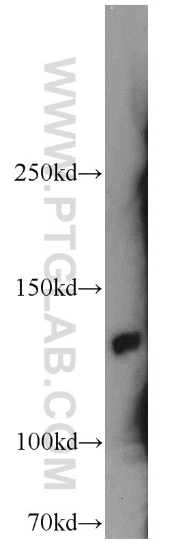 Western Blot (WB) analysis of Jurkat cells using SRRM1 Polyclonal antibody (12822-1-AP)