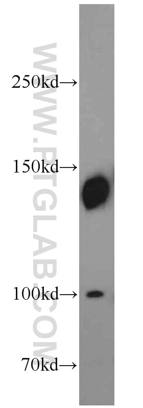 Western Blot (WB) analysis of HeLa cells using SRRM1 Polyclonal antibody (12822-1-AP)