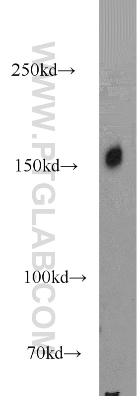 Western Blot (WB) analysis of UV treated HEK-293 using SRRM1 Polyclonal antibody (12822-1-AP)