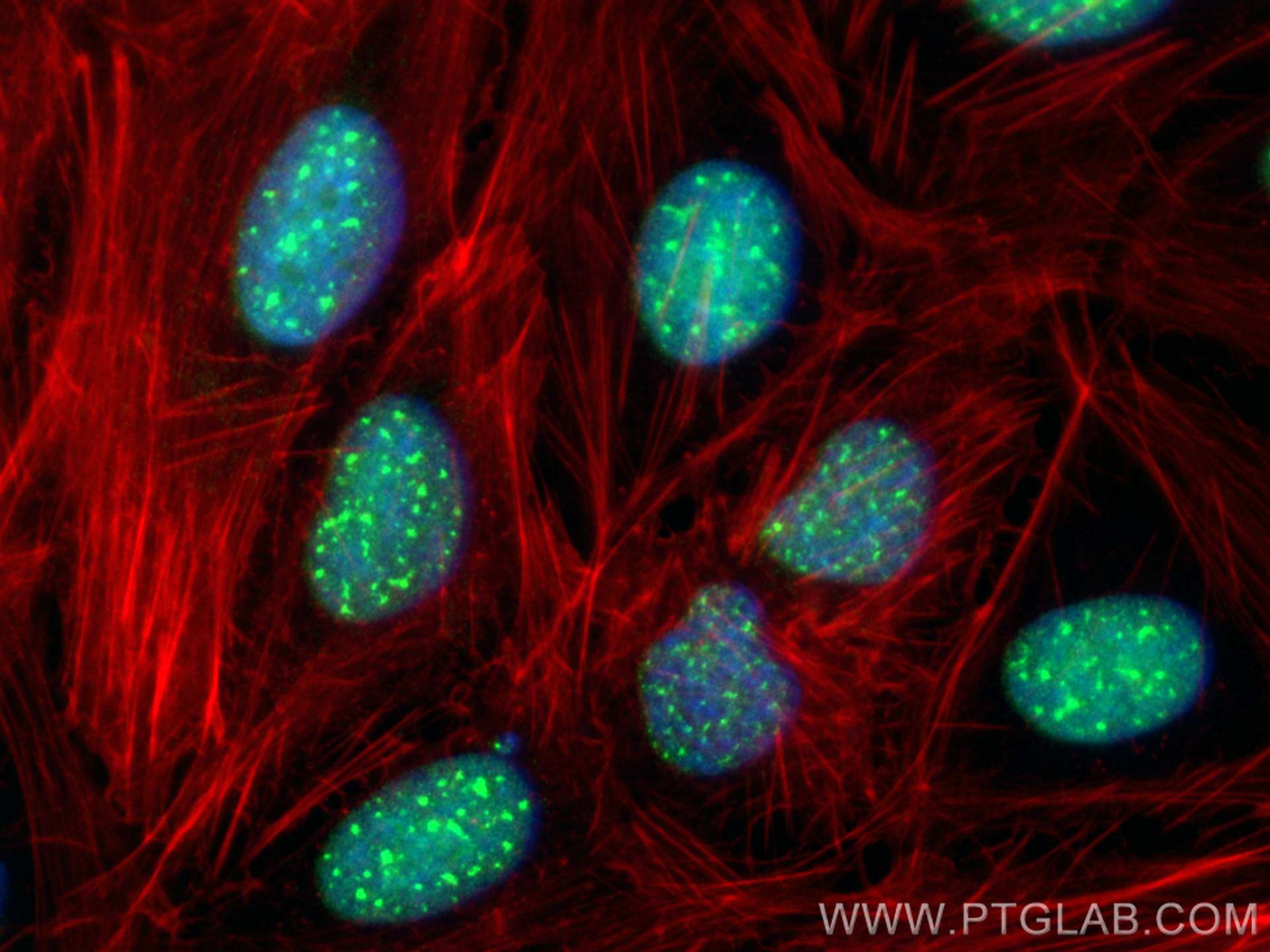 Immunofluorescence (IF) / fluorescent staining of U2OS cells using SRRM2 Polyclonal antibody (30741-1-AP)
