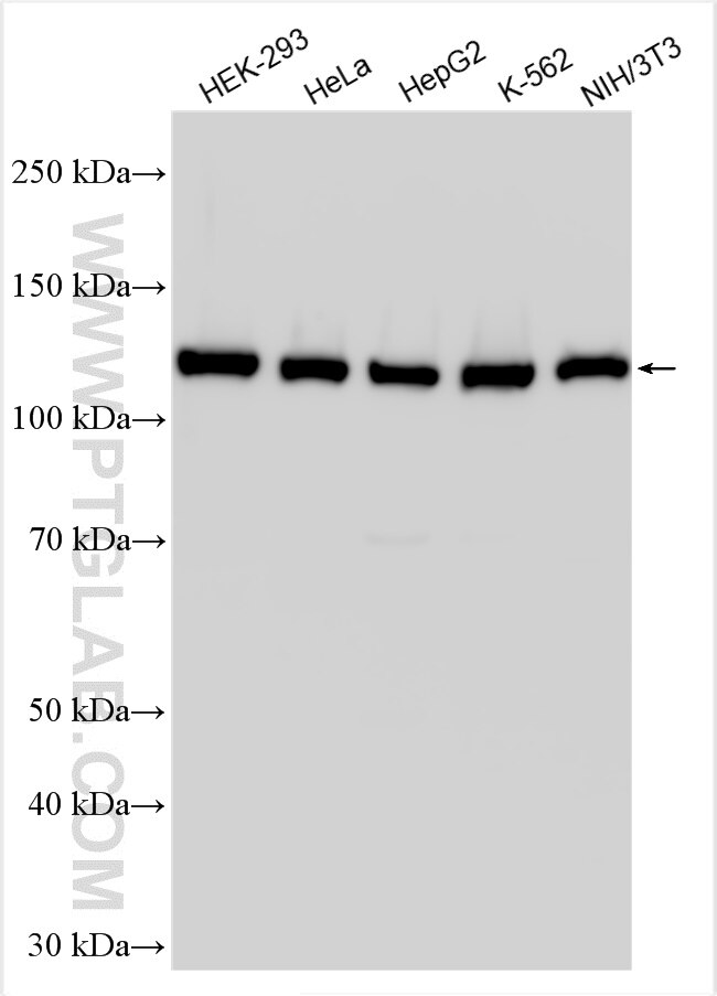 Western Blot (WB) analysis of various lysates using SRRT Polyclonal antibody (20353-1-AP)
