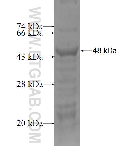 SRRT fusion protein Ag1185 SDS-PAGE