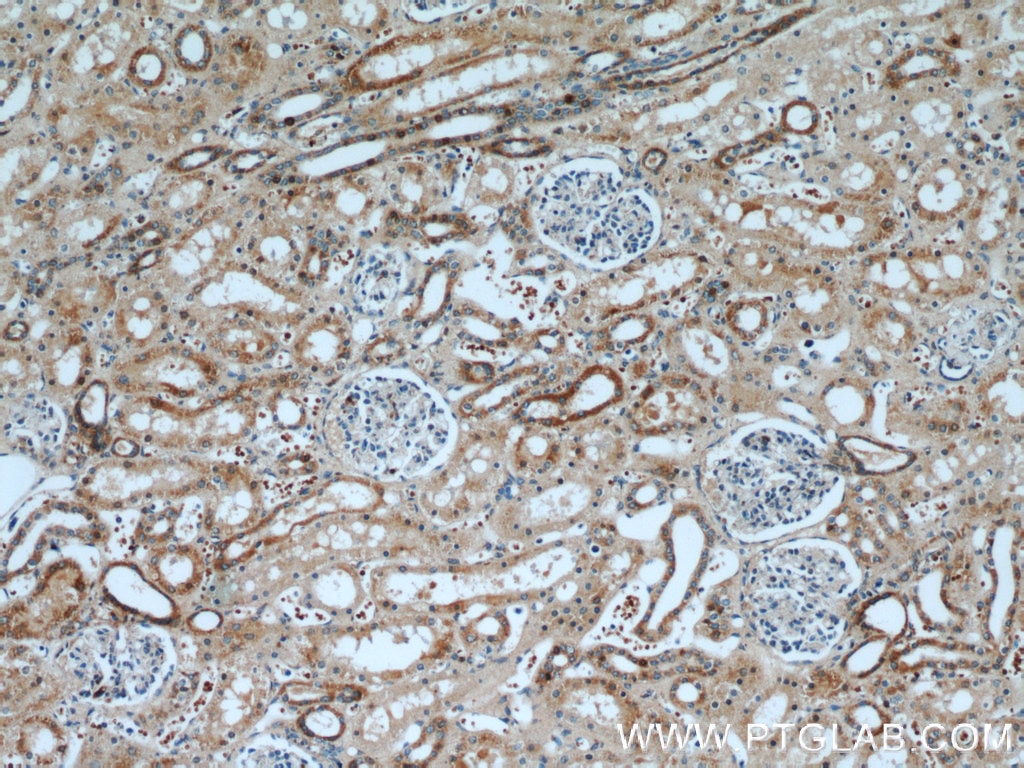 Immunohistochemistry (IHC) staining of human kidney tissue using SRX1 Polyclonal antibody (14273-1-AP)