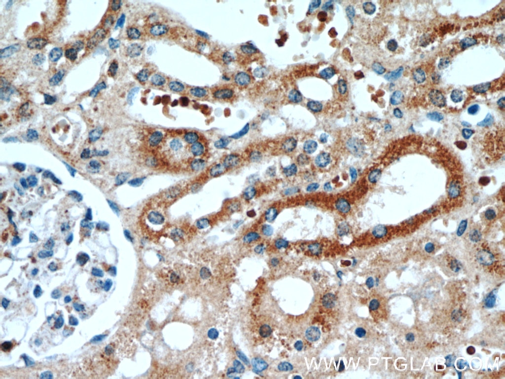 Immunohistochemistry (IHC) staining of human kidney tissue using SRX1 Polyclonal antibody (14273-1-AP)