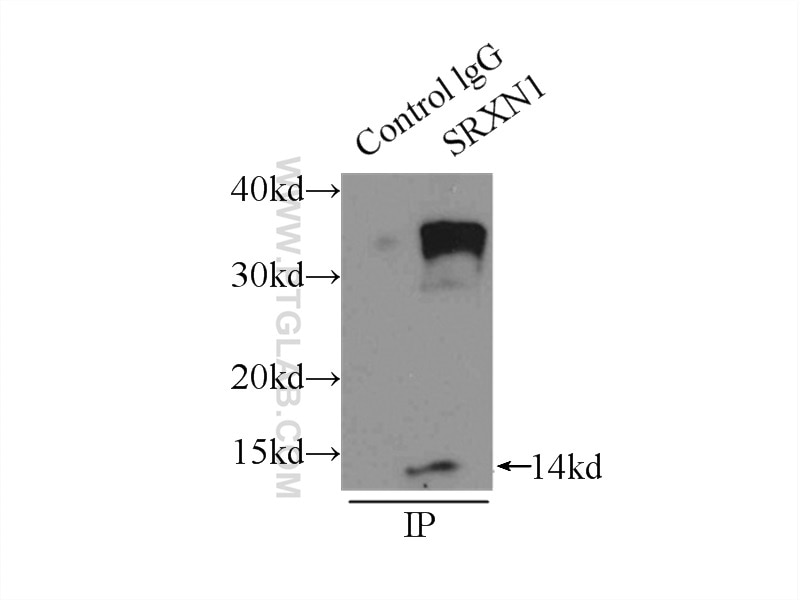 Immunoprecipitation (IP) experiment of A549 cells using SRX1 Polyclonal antibody (14273-1-AP)