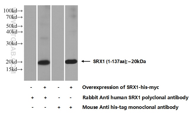 Western Blot (WB) analysis of Transfected HEK-293 cells using SRX1 Polyclonal antibody (14273-1-AP)