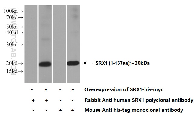 WB analysis of Transfected HEK-293 using 14273-1-AP