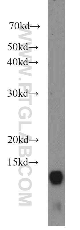 Western Blot (WB) analysis of A549 cells using SRX1 Polyclonal antibody (14273-1-AP)