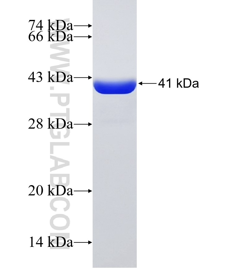 SRX1 fusion protein Ag31537 SDS-PAGE