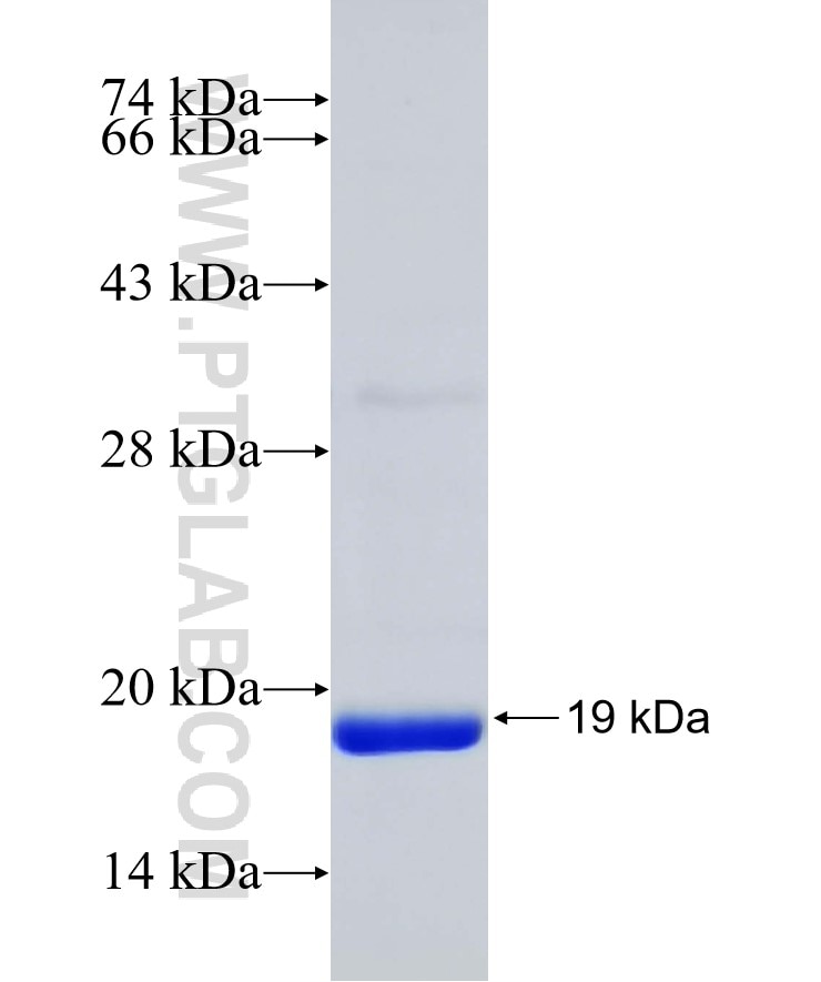 SRX1 fusion protein Ag31573 SDS-PAGE
