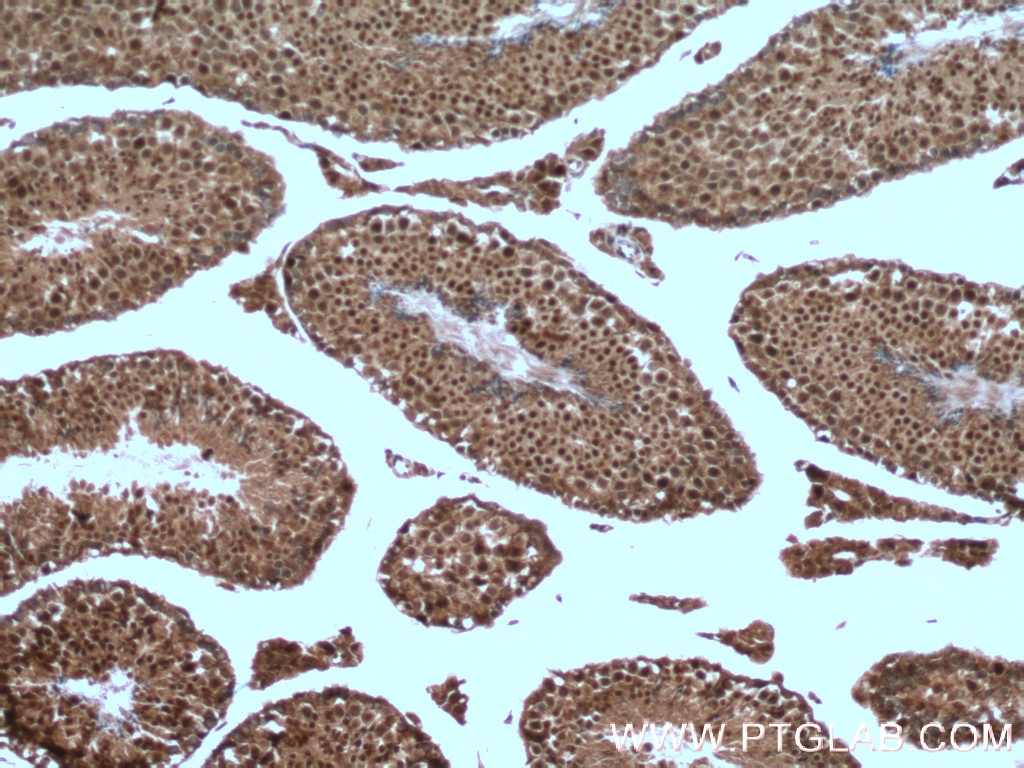 Immunohistochemistry (IHC) staining of mouse testis tissue using SRY Polyclonal antibody (17930-1-AP)