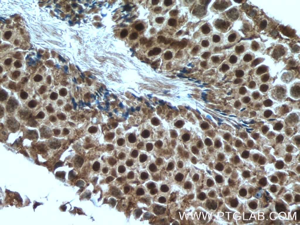 Immunohistochemistry (IHC) staining of mouse testis tissue using SRY Polyclonal antibody (17930-1-AP)