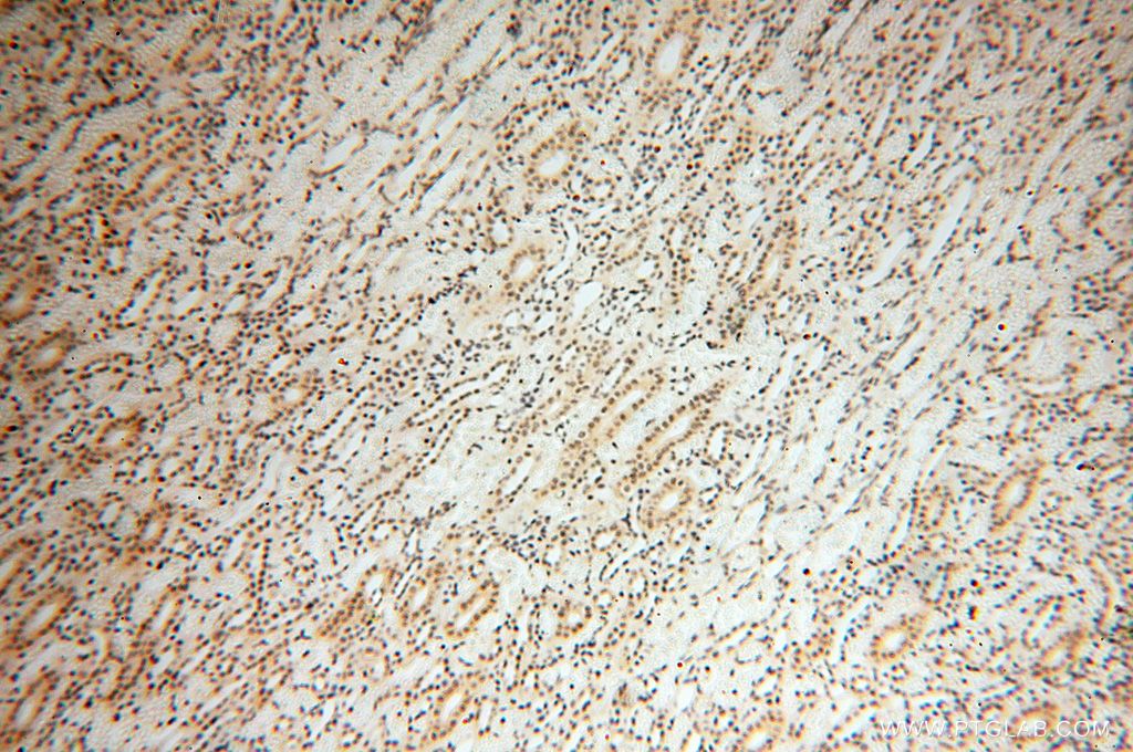 Immunohistochemistry (IHC) staining of human kidney tissue using SRY Polyclonal antibody (17930-1-AP)