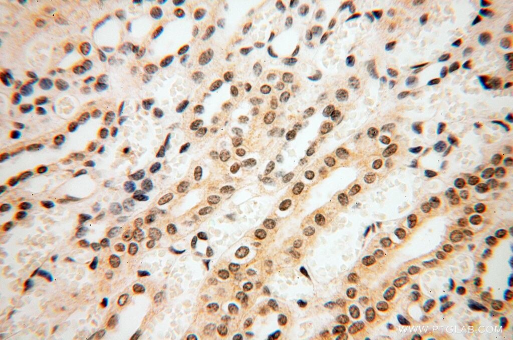 Immunohistochemistry (IHC) staining of human kidney tissue using SRY Polyclonal antibody (17930-1-AP)