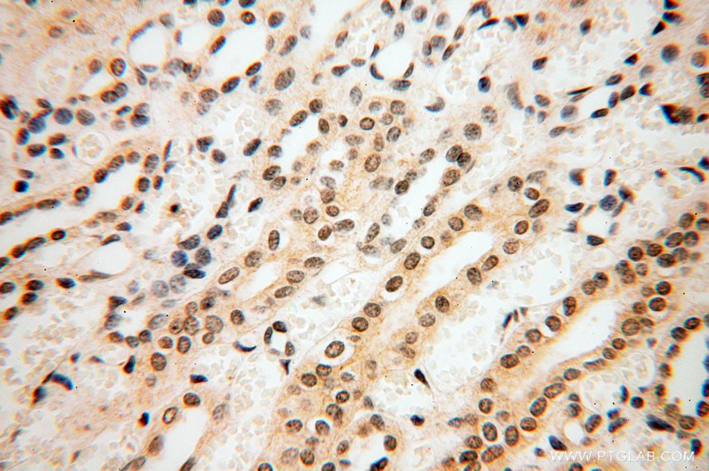 IHC staining of human kidney using 17930-1-AP