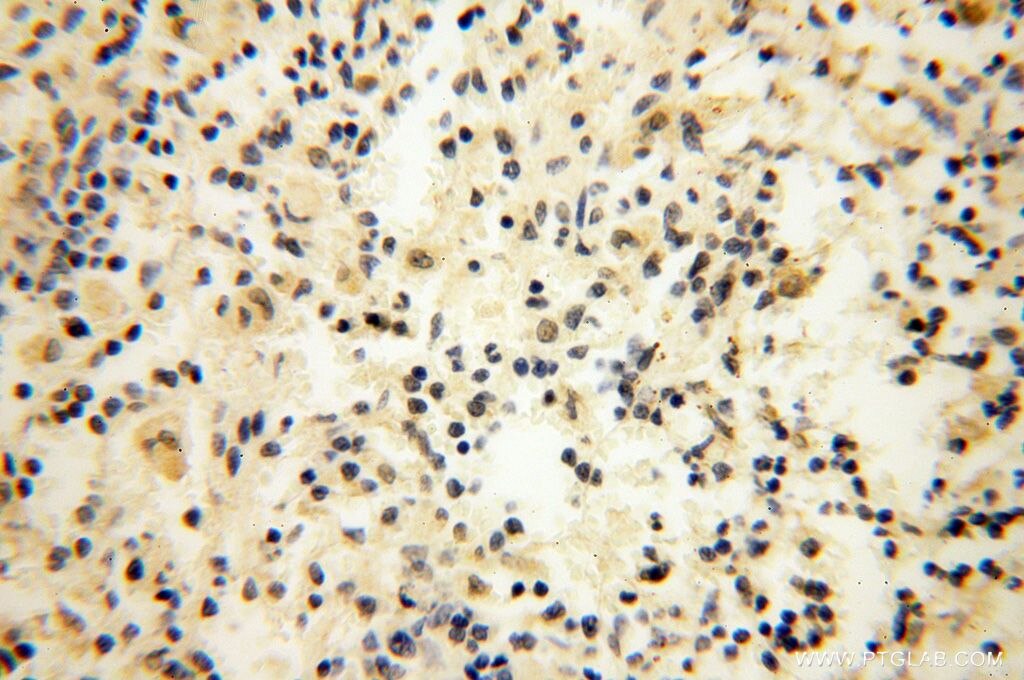 Immunohistochemistry (IHC) staining of human spleen tissue using SRY Polyclonal antibody (17930-1-AP)