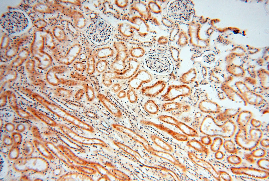 Immunohistochemistry (IHC) staining of human kidney tissue using SRY Polyclonal antibody (17930-1-AP)