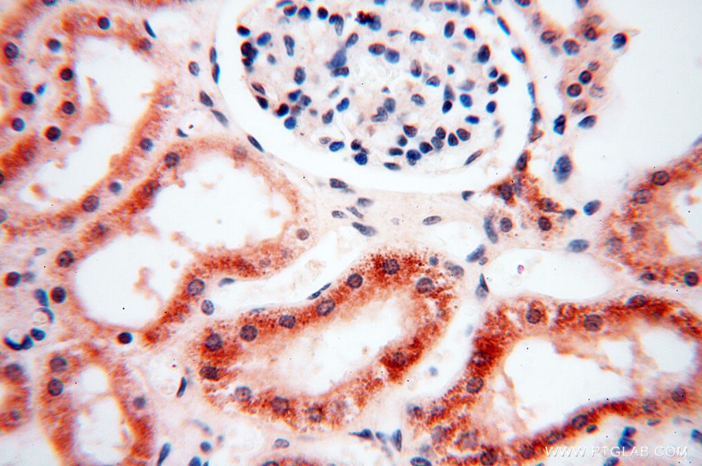 Immunohistochemistry (IHC) staining of human kidney tissue using SRY Polyclonal antibody (17930-1-AP)