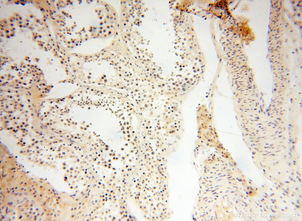 Immunohistochemistry (IHC) staining of human testis tissue using SRY Polyclonal antibody (17930-1-AP)