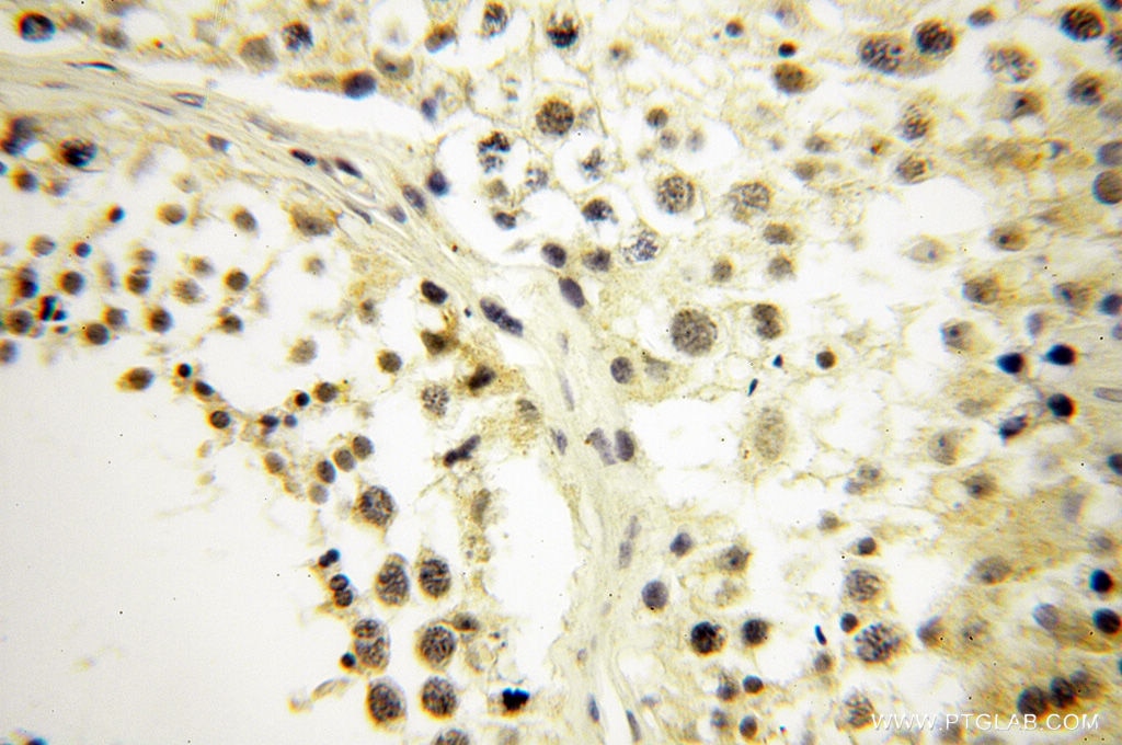 Immunohistochemistry (IHC) staining of human testis tissue using SRY Polyclonal antibody (17930-1-AP)