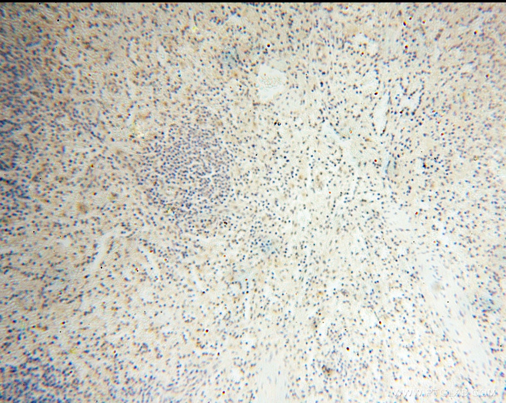 IHC staining of human spleen using 17930-1-AP