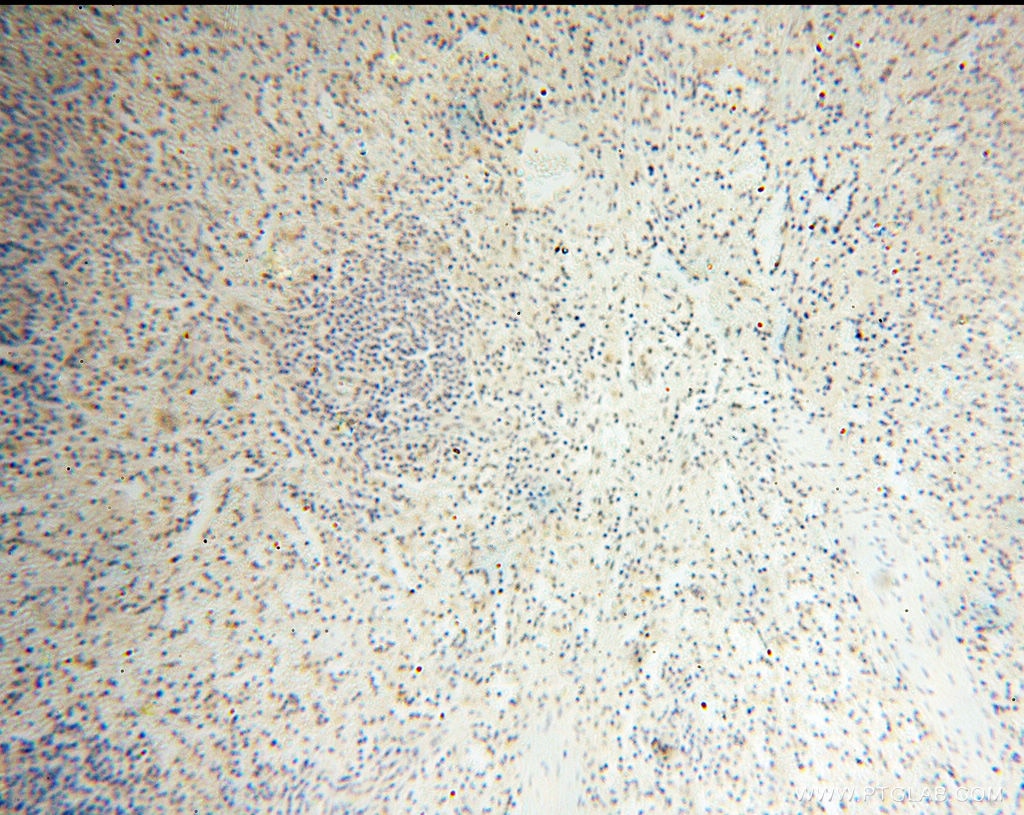 Immunohistochemistry (IHC) staining of human spleen tissue using SRY Polyclonal antibody (17930-1-AP)