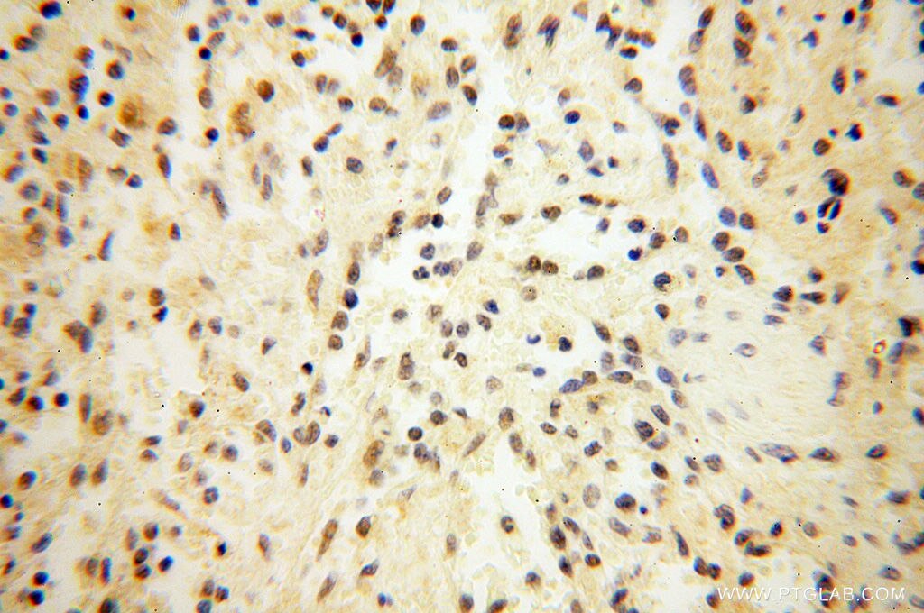 Immunohistochemistry (IHC) staining of human spleen tissue using SRY Polyclonal antibody (17930-1-AP)