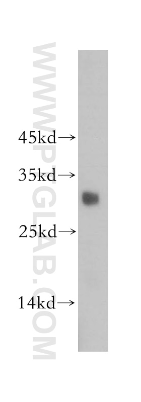 Western Blot (WB) analysis of human testis tissue using SRY Polyclonal antibody (17930-1-AP)