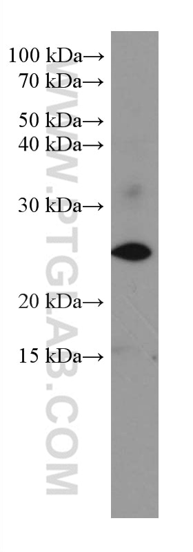 Western Blot (WB) analysis of LNCaP cells using SRY Monoclonal antibody (67349-1-Ig)