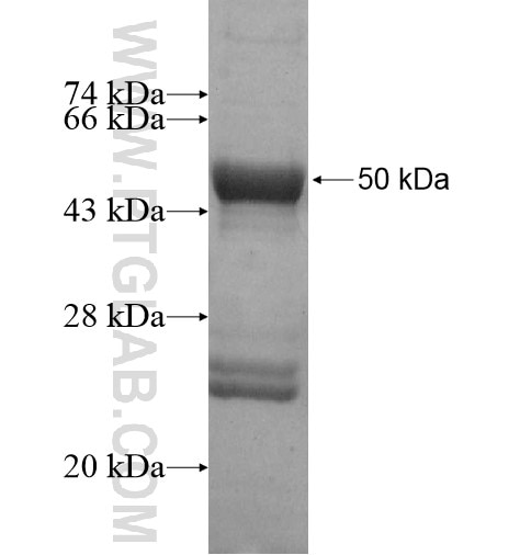 SRY fusion protein Ag12360 SDS-PAGE