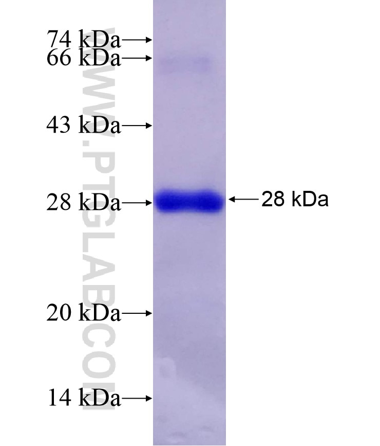 SRY fusion protein Ag12610 SDS-PAGE