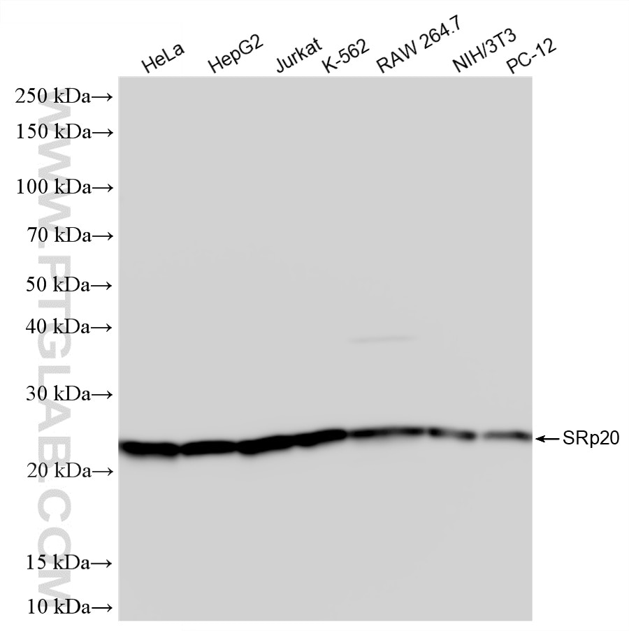 Various lysates were subjected to SDS PAGE followed by western blot with 87438-1-RR (SRp20 antibody) at dilution of 1:10000 incubated at room temperature for 1.5 hours. Western Blot (WB) analysis of various lysates using SRp20 Recombinant monoclonal antibody (87438-1-RR)