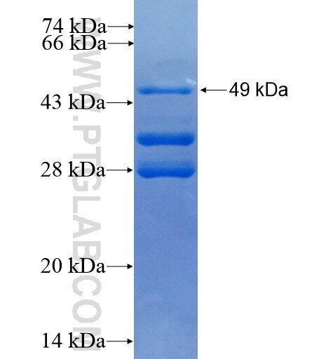 SRp20 fusion protein Ag1341 SDS-PAGE