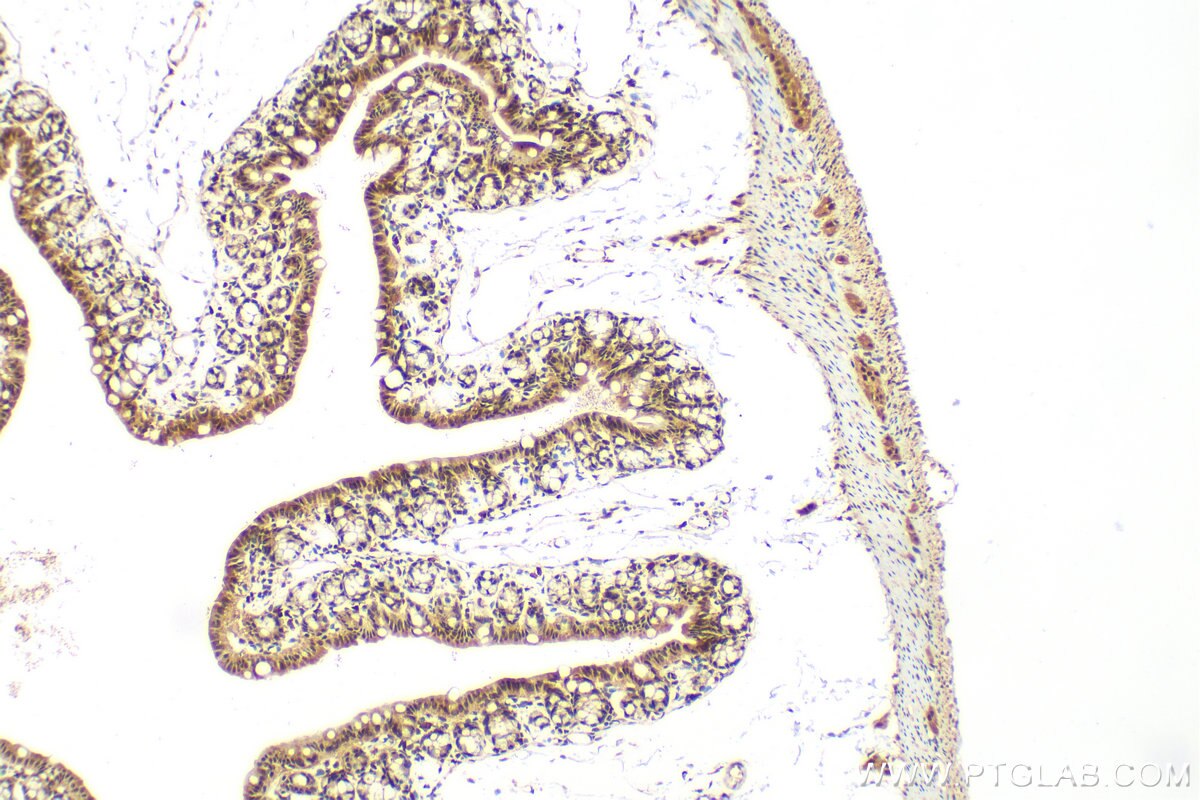 Immunohistochemistry (IHC) staining of mouse colon tissue using SS18 Polyclonal antibody (22185-1-AP)