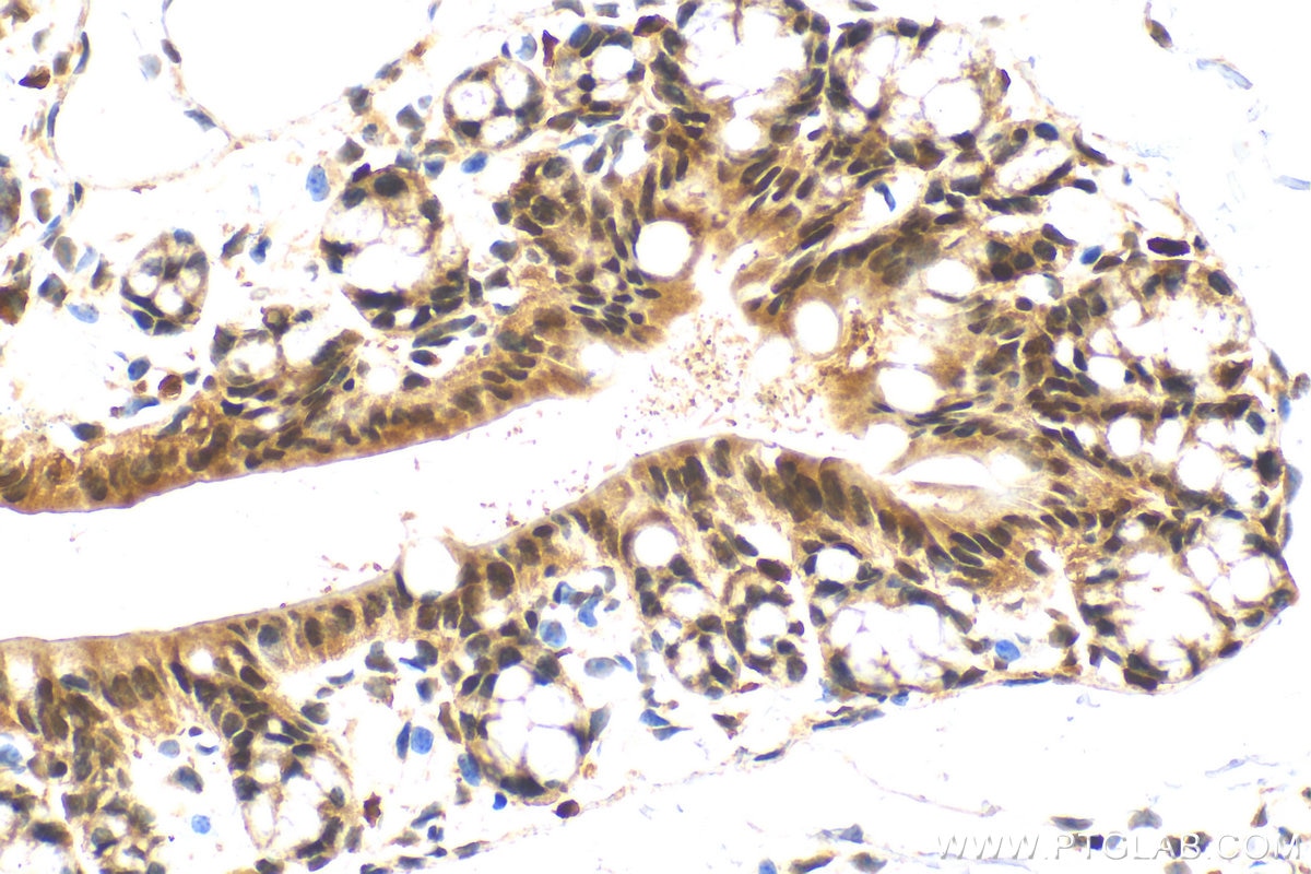 Immunohistochemistry (IHC) staining of mouse colon tissue using SS18 Polyclonal antibody (22185-1-AP)