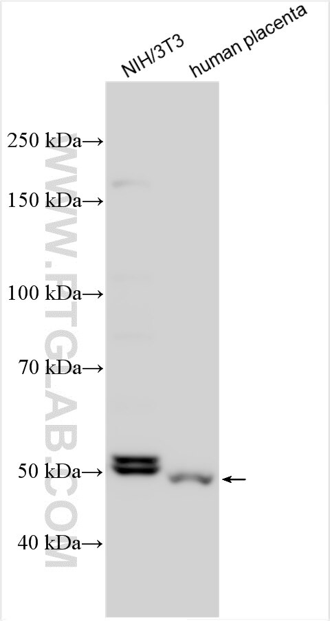 Western Blot (WB) analysis of various lysates using SS18 Polyclonal antibody (22185-1-AP)