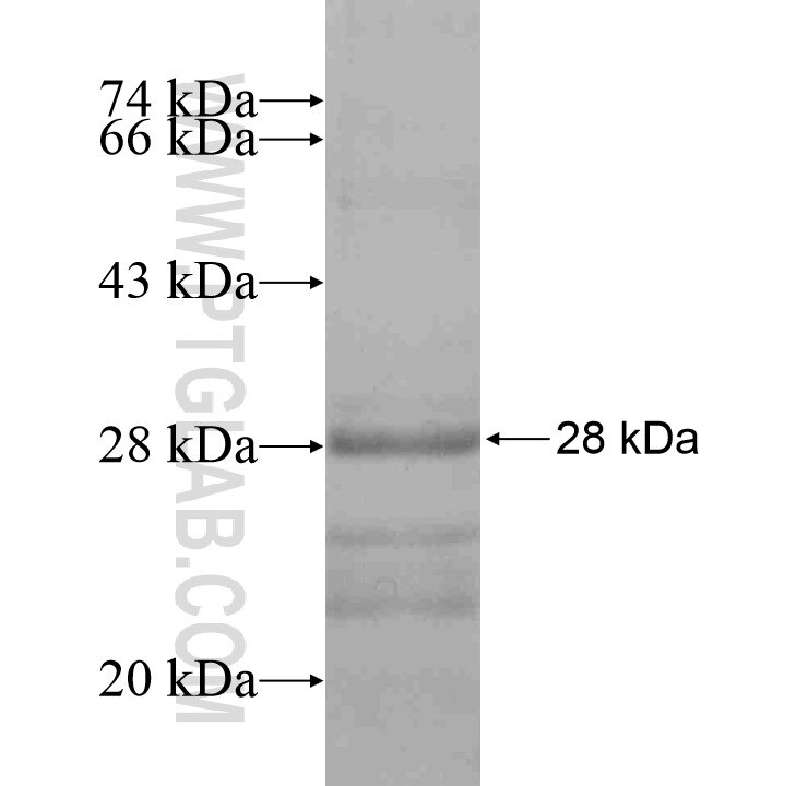 SS18 fusion protein Ag16743 SDS-PAGE