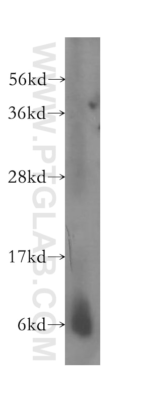 Western Blot (WB) analysis of human liver tissue using SS18L2 Polyclonal antibody (11817-1-AP)