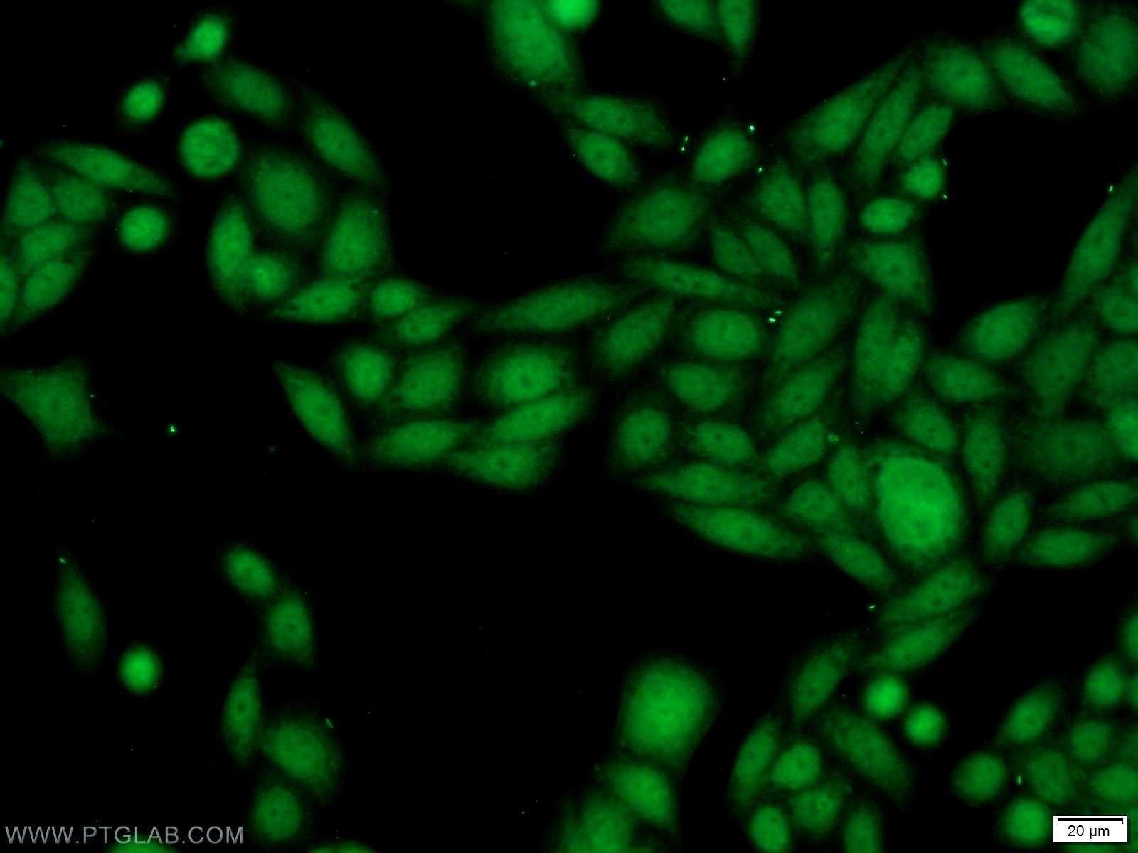 Immunofluorescence (IF) / fluorescent staining of HeLa cells using SSB Polyclonal antibody (11720-1-AP)