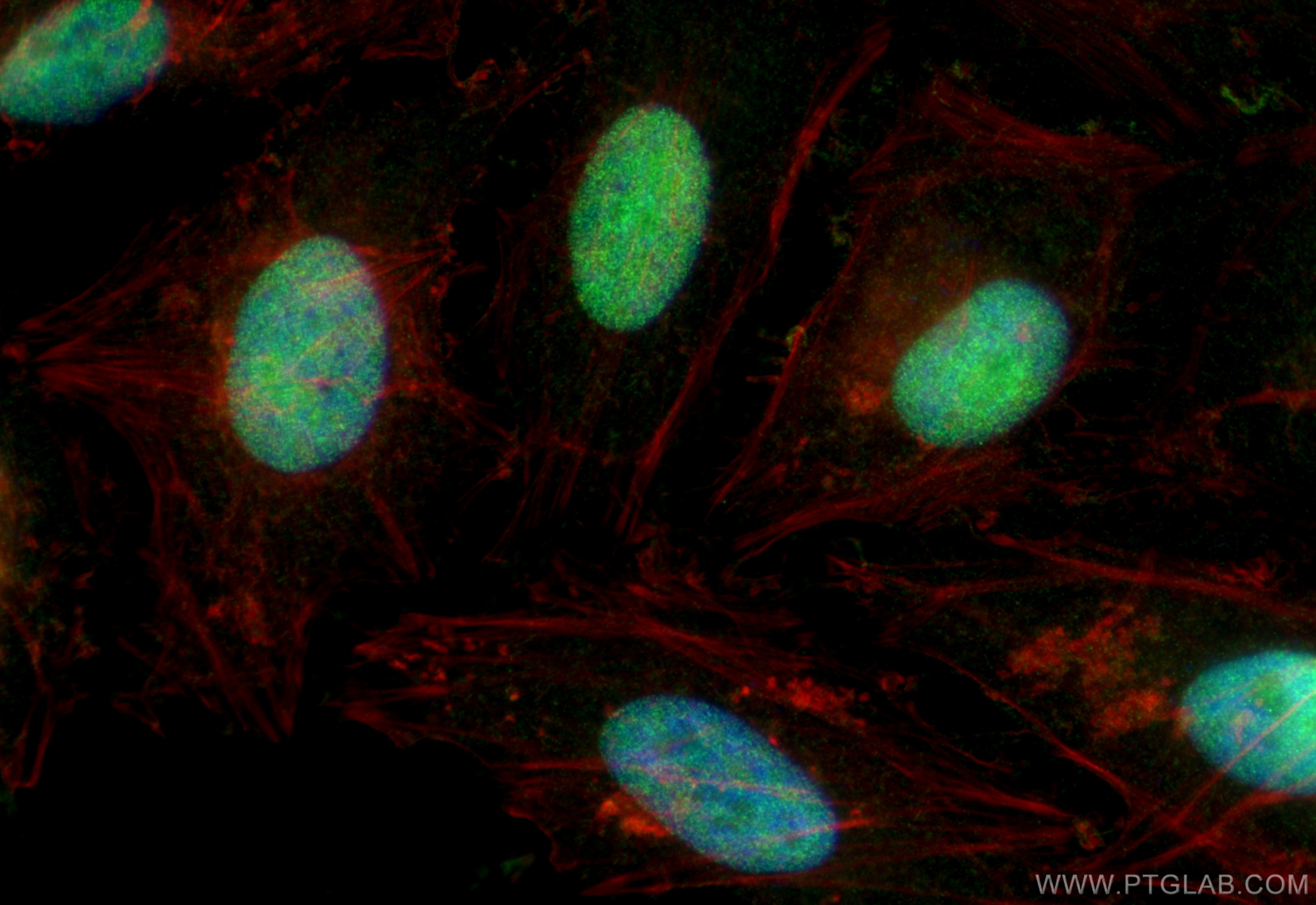 Immunofluorescence (IF) / fluorescent staining of HeLa cells using SSB Polyclonal antibody (11720-1-AP)