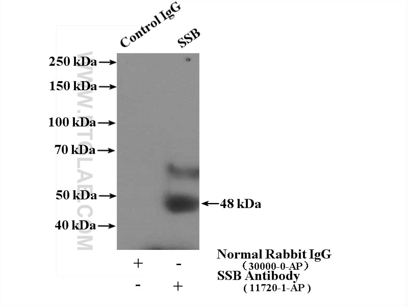 Immunoprecipitation (IP) experiment of Jurkat cells using SSB Polyclonal antibody (11720-1-AP)