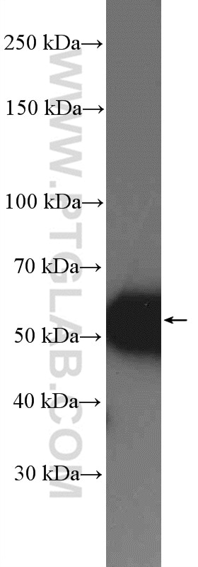 Western Blot (WB) analysis of Jurkat cells using SSB Polyclonal antibody (11720-1-AP)