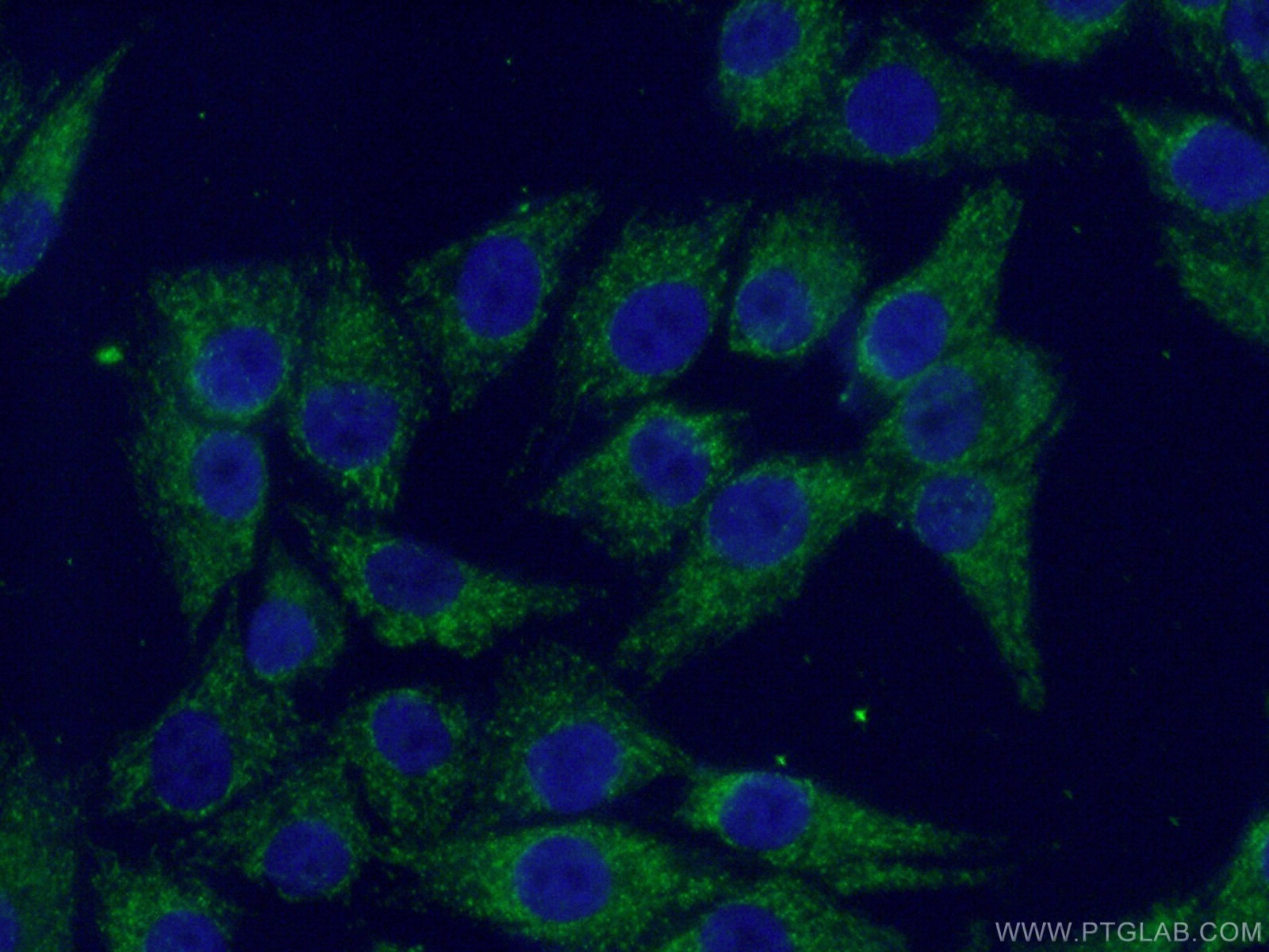 Immunofluorescence (IF) / fluorescent staining of A375 cells using SSBP1 Polyclonal antibody (12212-1-AP)